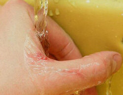 Nước axit mạnh diệt khuẩn, khử mùi, khử trùng